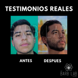 VROLOXIDIL® BEARD (Barba)