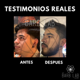 VROLOXIDIL® BEARD (Barba)